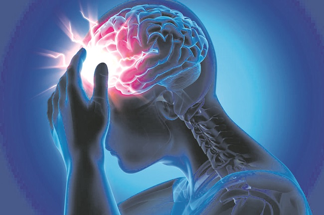 Starke Kopfschmerzen - Migrane - Medizinische Illustration - 3D Rendering